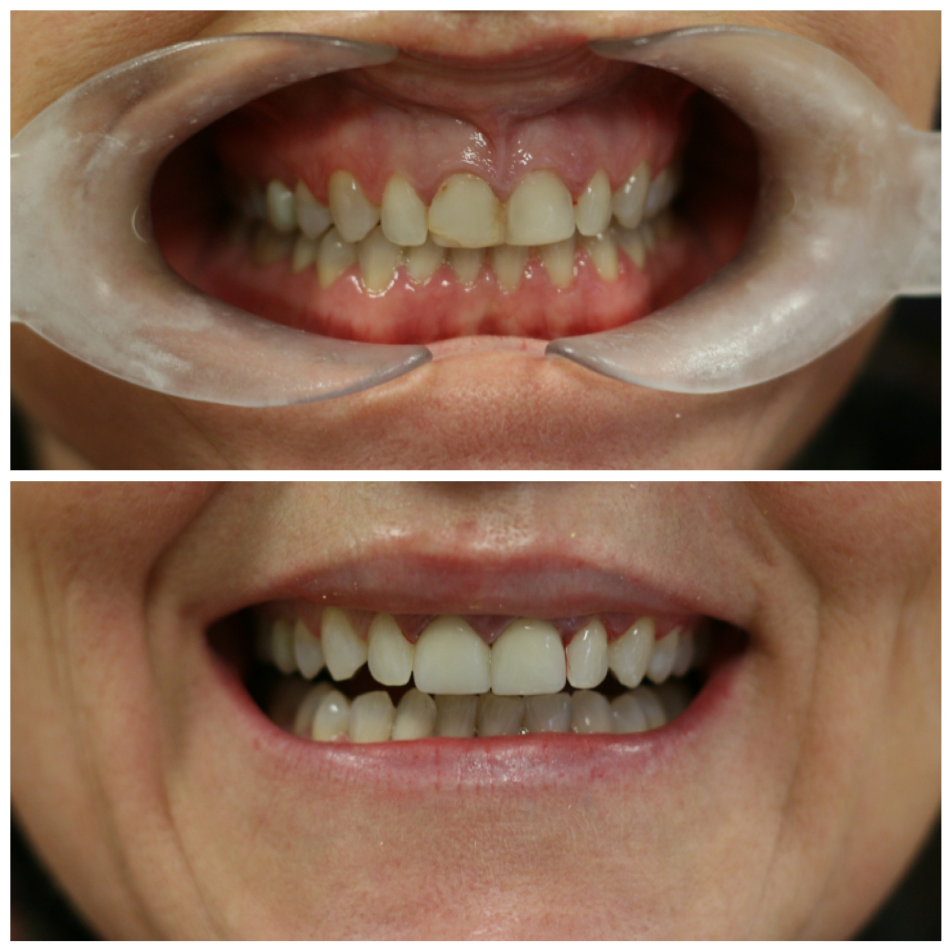 Smile No. 8