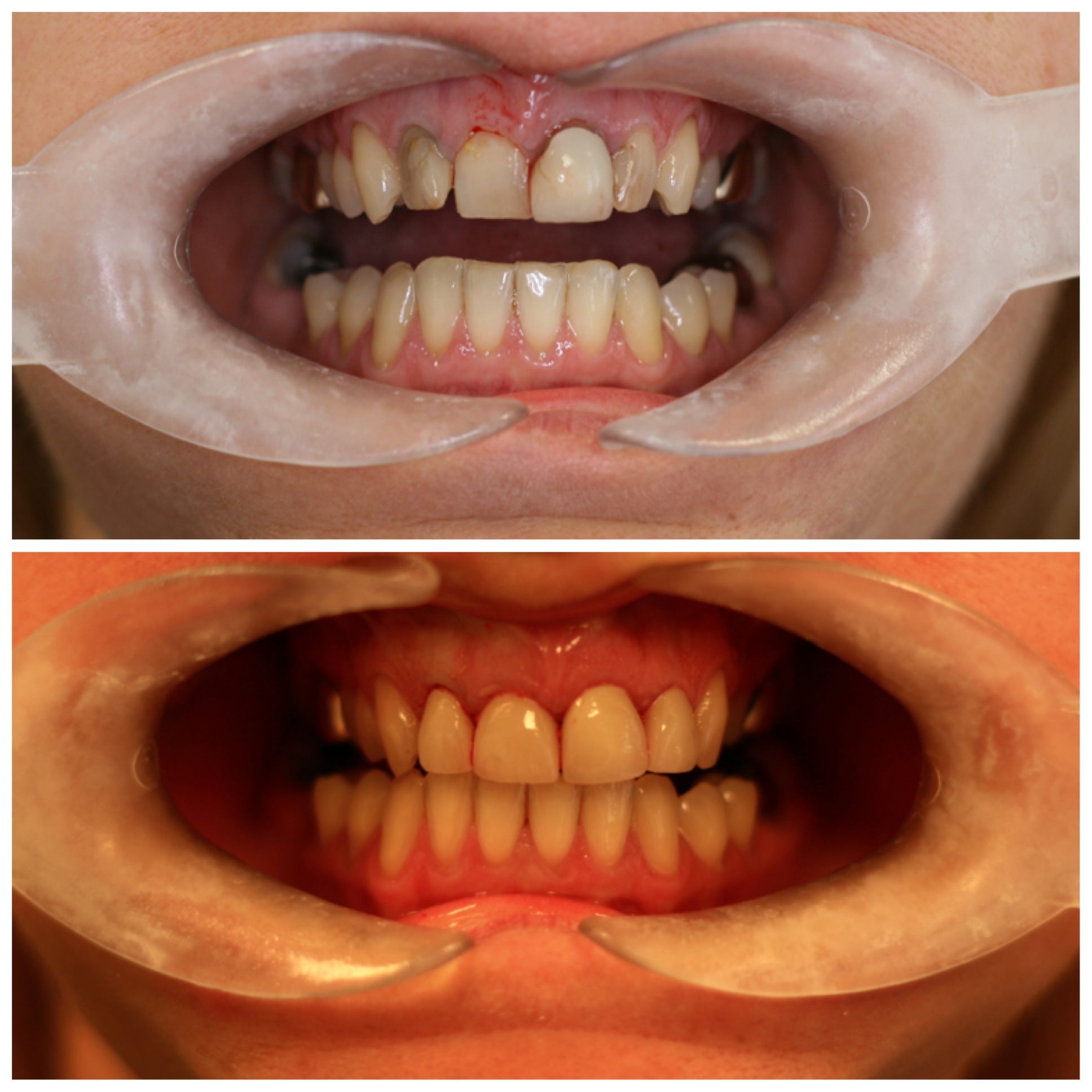 Smile No. 18