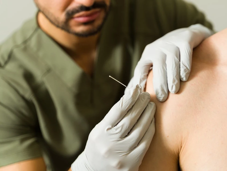 What Is Dry Needling — And Is It Right for You?