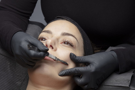 dermaplaning-1-scaled.jpeg