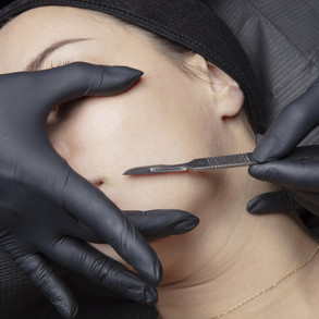 dermaplaning.jpeg
