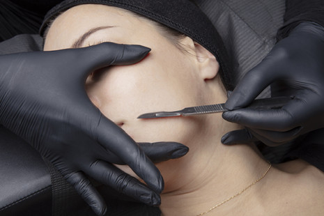 dermaplaning.jpeg