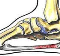 custom made orthotics