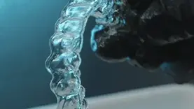 Attachment-free shape memory aligner – invisible orthodontic appliance for clear aligner treatment in Dubai and Sharjah