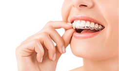 Invisalign Sharjah for invisible orthodontic transformations with Dr. Srinivasa Rao Bogavilli at World Class Orthodontics – enhance your smile!