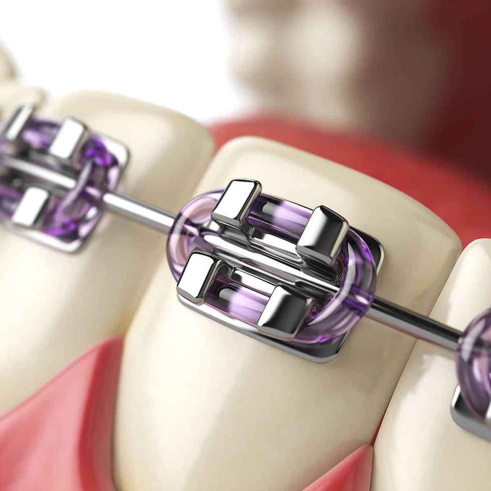 Damon Braces in Dubai, Sharjah & Abu Dhabi