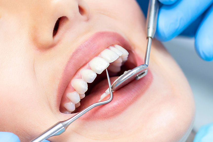 female-at-dentist-for-teeth-examination.