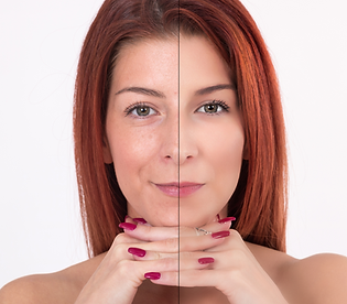 Growth Factor Skin Rejuvenation.png