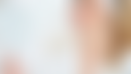 Microbotox : La Nouvelle Révolution en Médecine Esthétique pour une Peau Éclatante et Régénérée