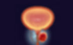 ree