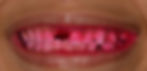 ree