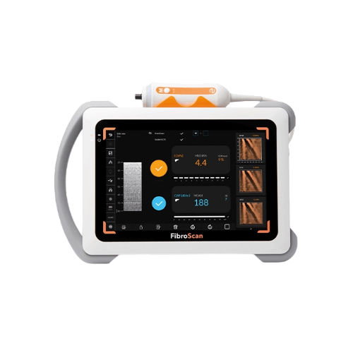 LABFISH_Clinical_trial_supplies_Echosens_R__FibroScan_R__mini_430plus-500x500.jpg