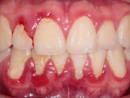 Cómo aprovechar tu cita de salud periodontal en Puebla