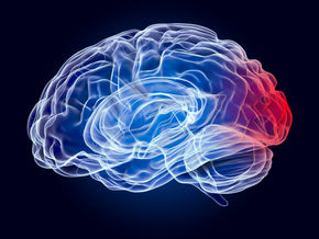 Hematoma Epidural Intracraniano. Revisão da literatura publicado no ABNC