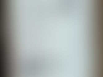 What It's Like For a Lupus Patient to Experience Covid-19