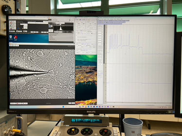 The first ever recording at AURORA