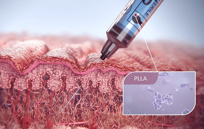 Best biostimulator clinic in Thailand