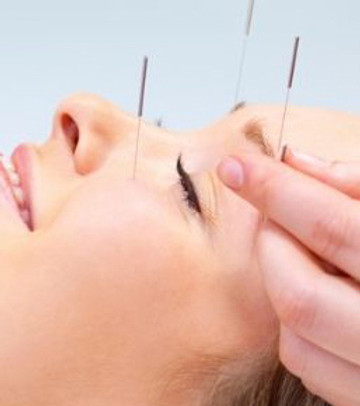 Facial Acupuncture Hilo.jpg
