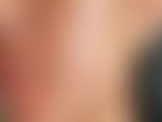 Skincare for Special Needs Acne, Sensitivity, and Post-Procedure Care