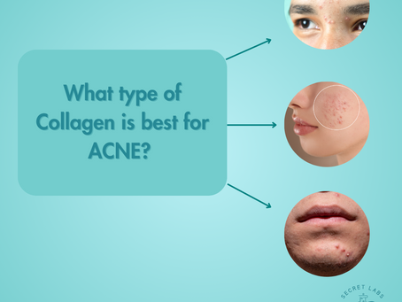 Which collagen is best for ACNE?