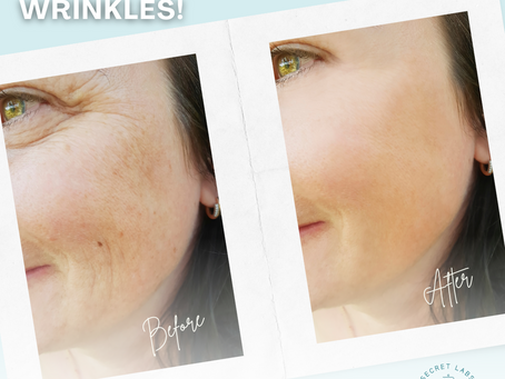 Collagen before and after