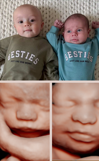 2D 3D 4D 5D Ultrasound Vero Beach Florida Near Port St. Lucie