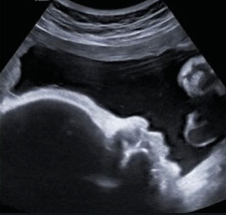 private ultrasound near me port st lucie vero beach