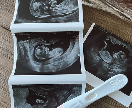 pregnancy vero beach.JPG