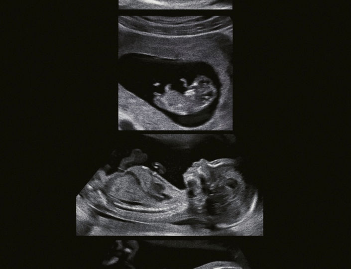 Pregnancy ultrasound near me in Port St. Lucie