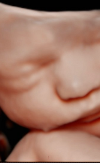 3d ultrasounds on the Treasure Coast
