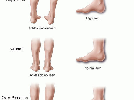 Running Shoes: 101