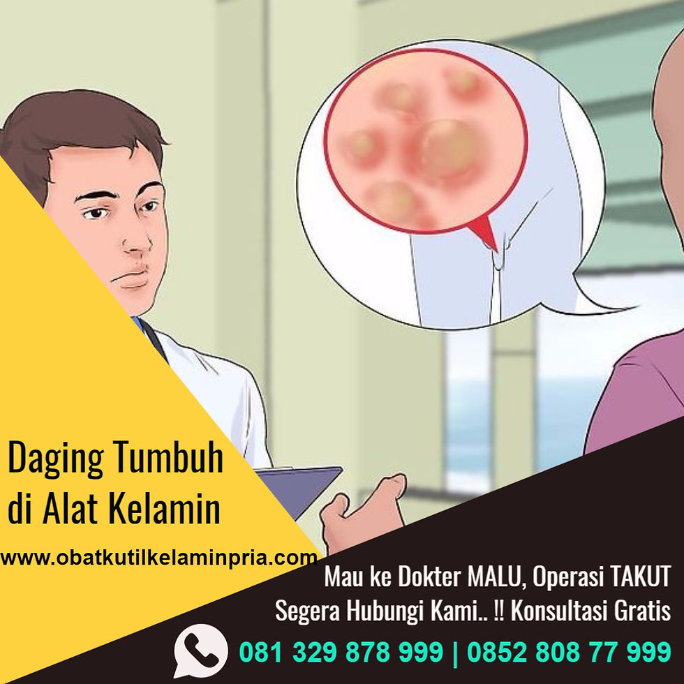 Cara Menghilangkan Kutil Kelamin Dg Bawang Putih