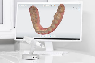 scanner-intraorale-3d.jpg