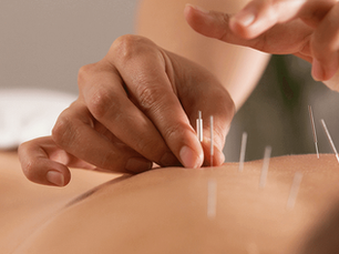 Are there benefits of acupuncture during pregnancy?