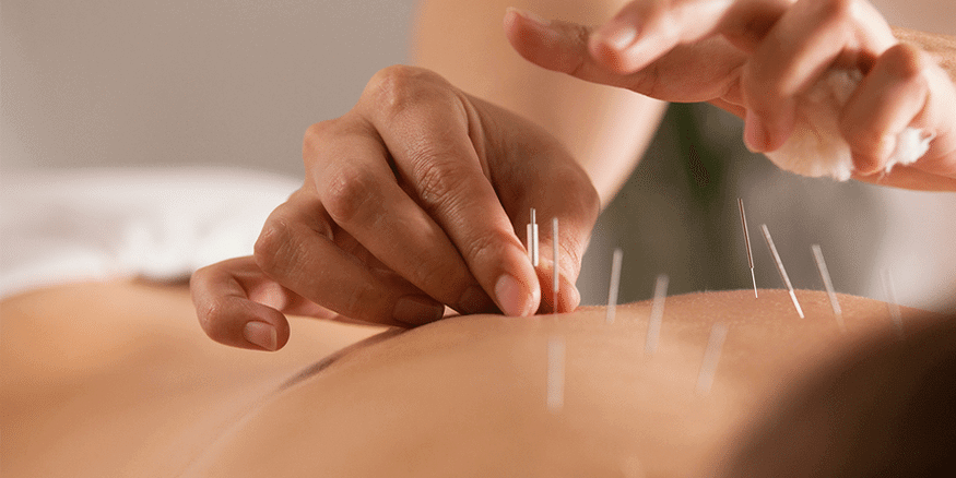 Acupuncture and Digestion