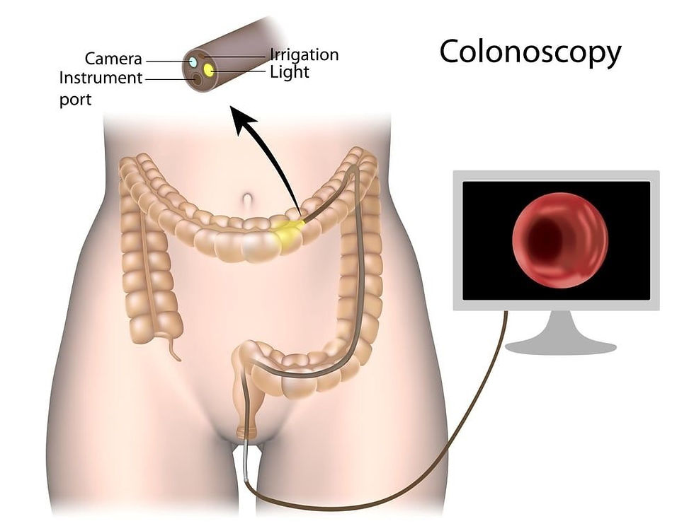 Doctor performing a colonoscopy procedure for colon cancer screening”