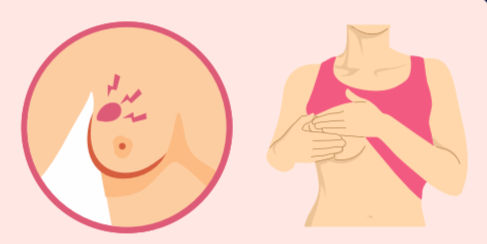 Brustkrebs-Infobroschüre in Leichter Sprache