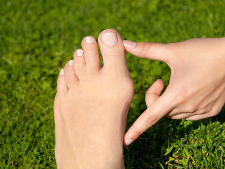 How to Choose Shoes for Bunions - 10 Top Tips