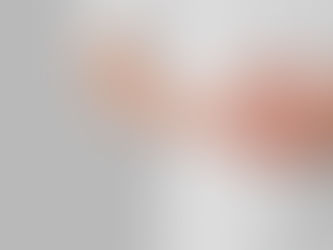 Perhatikan! Ini 6 Makanan yang Dapat Memperburuk Kondisi Kesehatan Usus