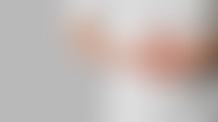 Perhatikan! Ini 6 Makanan yang Dapat Memperburuk Kondisi Kesehatan Usus