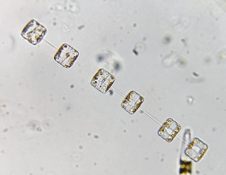 Late nights, tiny organisms & questionable life choices