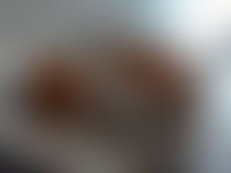 ¿Qué es el colágeno?