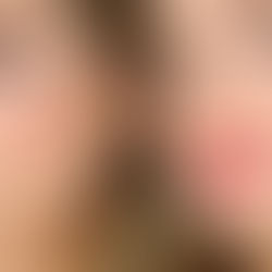 Plastic Surgery Trends in America You Can’t Ignore in 2025