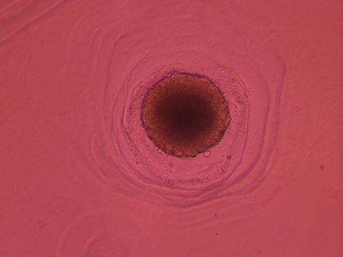 esferoide