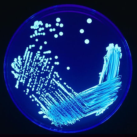 Legionella Wisconsin