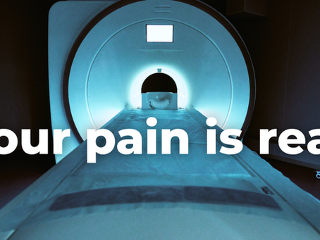 A Picture of 1000 Words and Zero Answers - Why Your Pain May Not Show Up in Imaging