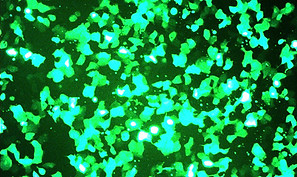 Magnefect_Lung_Epithelial_cells_1hr.jpg