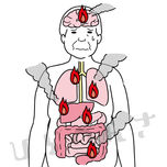体の中で炎症が起きている中年男性の内臓のイラスト