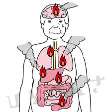 体の中で炎症が起きている中年男性の内臓のイラスト