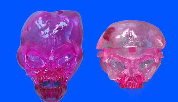 3-Dimensiona Model Pfeiffer Syndrome